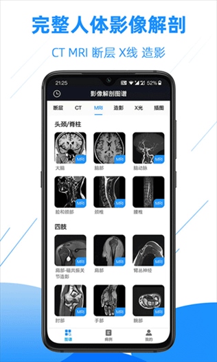 影像解剖图谱图片1